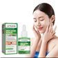 Salicylic Acid Anti Acn-e Face Serum Hydrating Fader Acne Mark Pimple Blackhead Removal Shrink Pores Oil Control Facial Essence