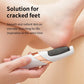 Foot Beauty Machine Electric Foot Grinder Automatic Foot Callus Rubbing Pedicure Dead Skin Callus Remover for Foot Rechargeable