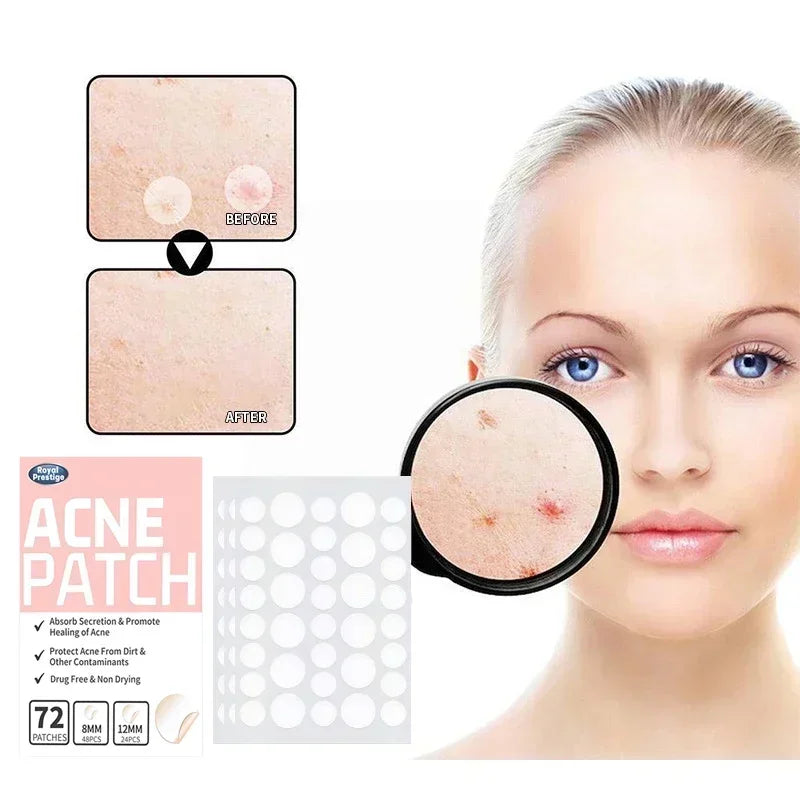 72-720Pcs Invisible Acne Patches Removal Pimple Anti-Acne Hydrocolloid Patches Spots Marks Concealer Repair Sticker Waterproof