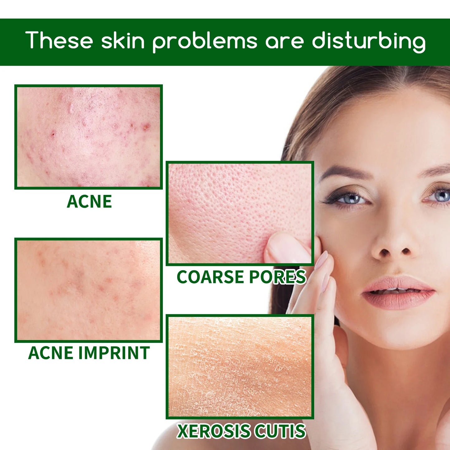 Salicylic Acid Anti Acn-e Face Serum Hydrating Fader Acne Mark Pimple Blackhead Removal Shrink Pores Oil Control Facial Essence